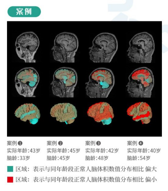 全景医学新技术实现影像诊断新跨越 智慧预警 护航健康