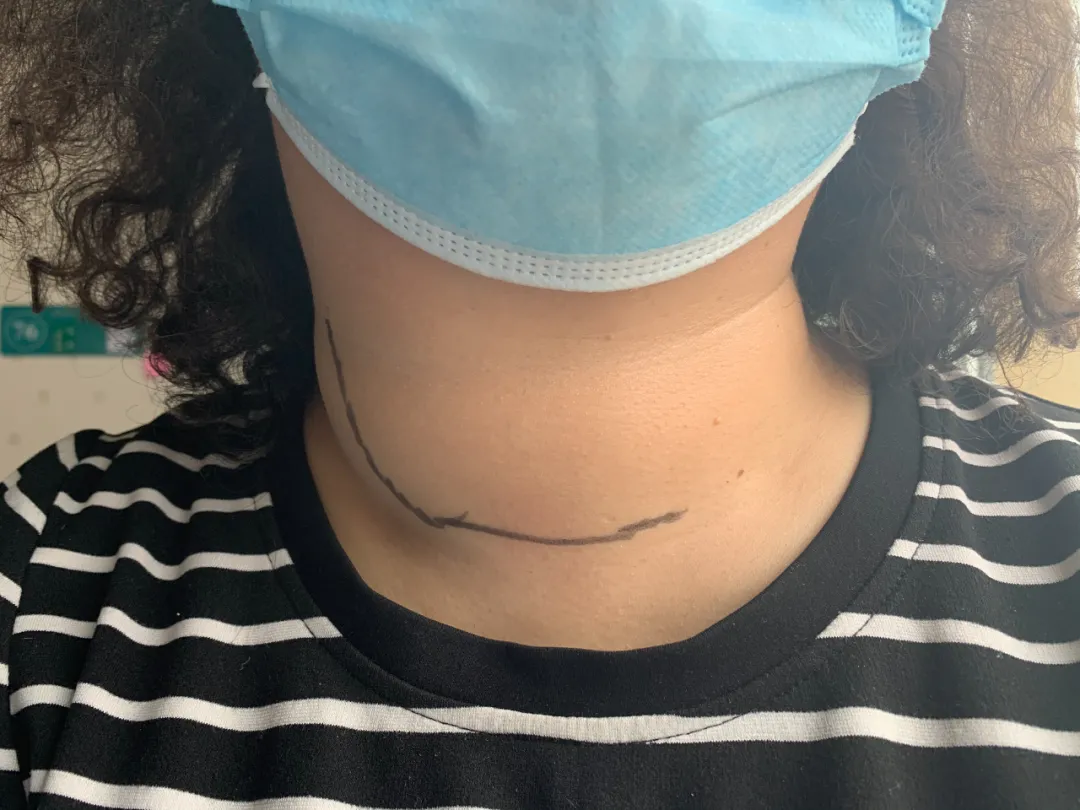 喘不过气！张姐被脖子上的俩大「腰子」扼住了喉咙