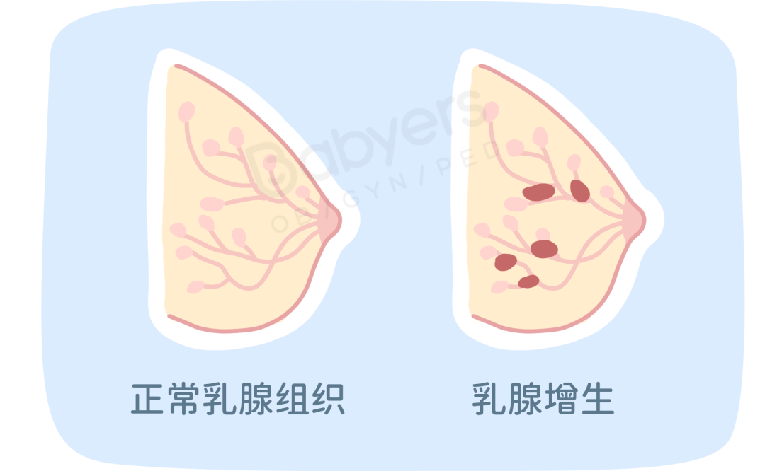杭州美华提醒：一张图教你「乳房自检」，乳腺问题早发现