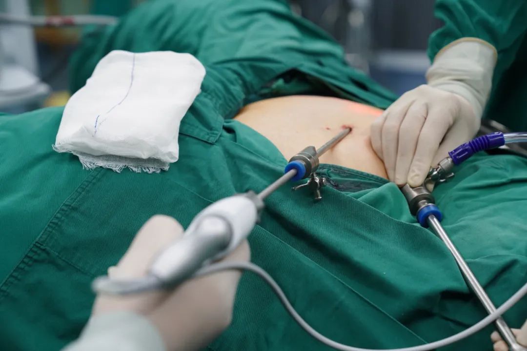 烟台海港医院妇产科为外阴癌患者成功实施手术，已顺利出院