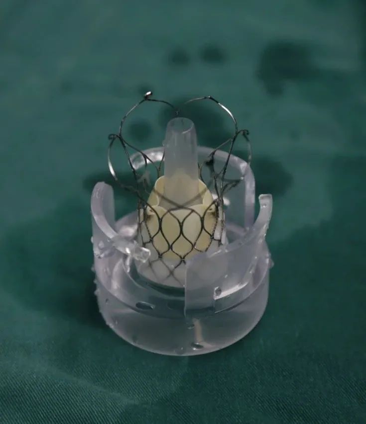 合肥京东方医院首例 TAVR 手术成功,心脏主动脉瓣置换现已进入「介入换新」时代
