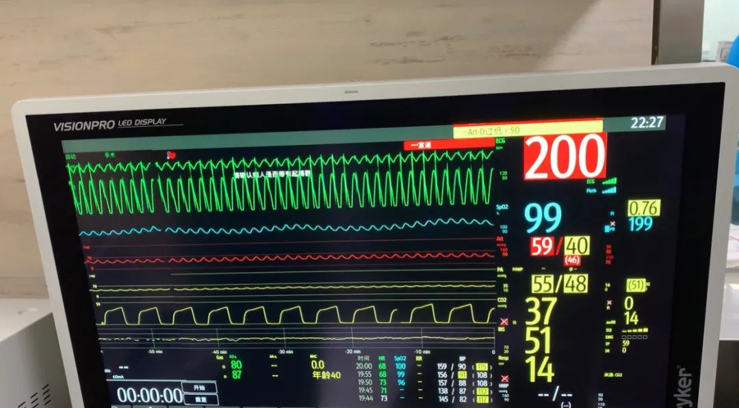 合肥京东方医院首例 TAVR 手术成功,心脏主动脉瓣置换现已进入「介入换新」时代