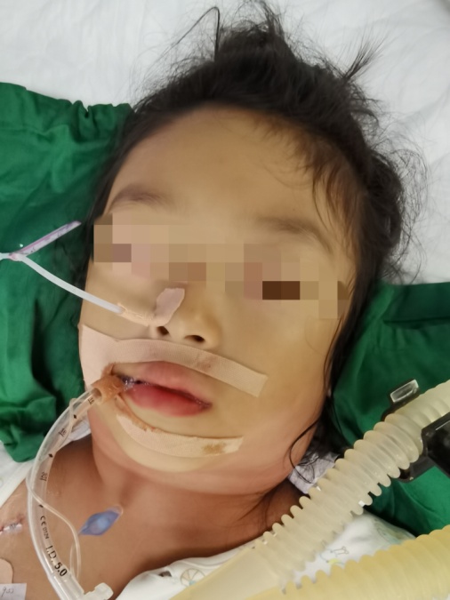 郴州市第一人民医院:别让大脖子捅出大篓子