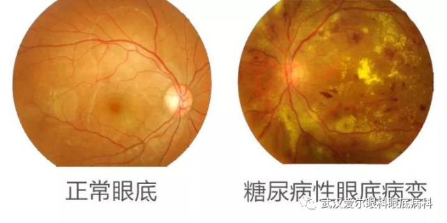 一起来看看人一生中可能遇到的眼底疾病有哪些？