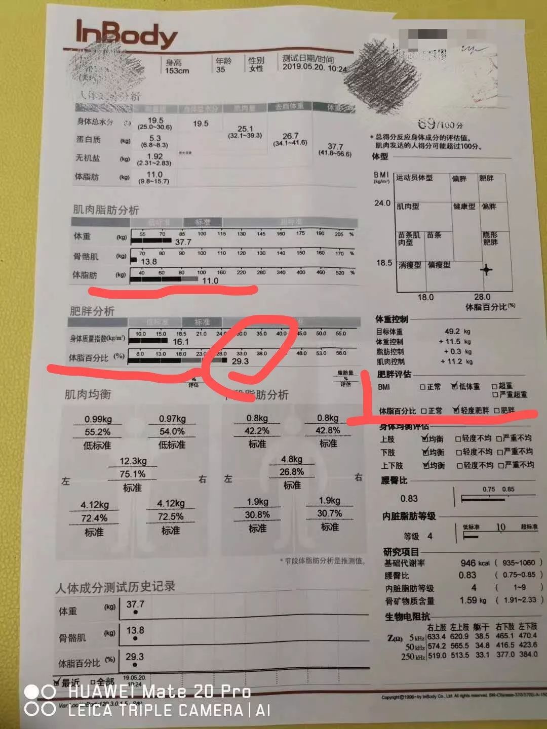 看起来「瘦」的多囊姐妹，体内藏着多少你看不到的脂肪？