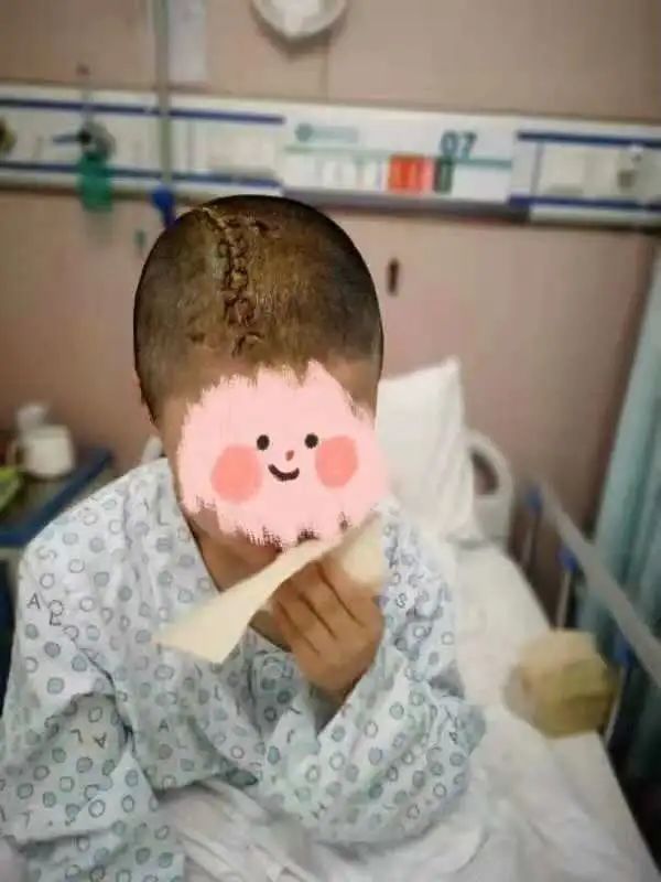 10 岁小孩遭遇车祸颅内出血，郑州市中心医院紧急救治