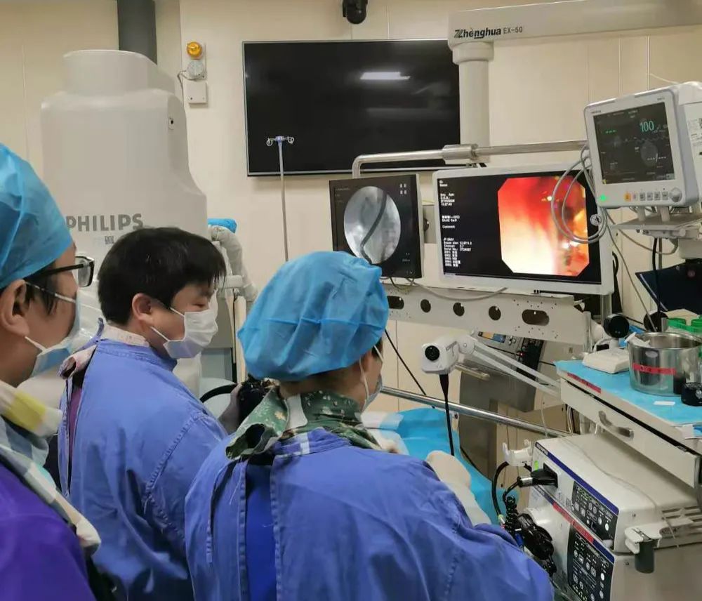 宜昌市第二人民医院应用 ERCP 成功为患者完成胆总管取石