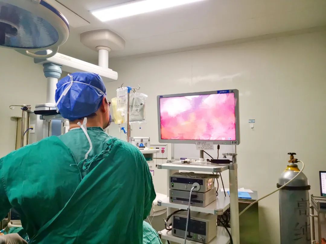 3D 腹腔镜技术在常德市第四人民医院成功开展