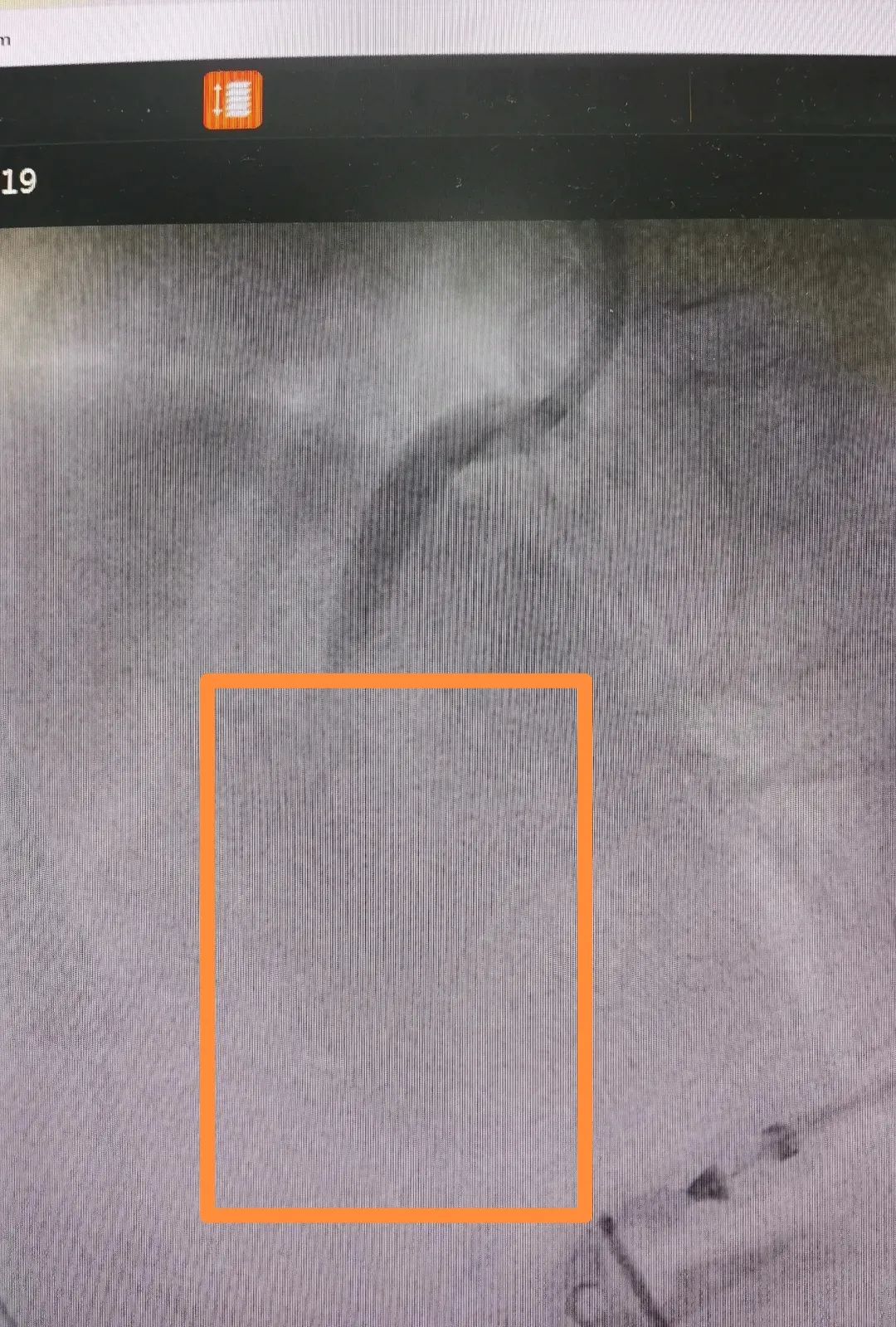 与时间竞速,护航生命之路