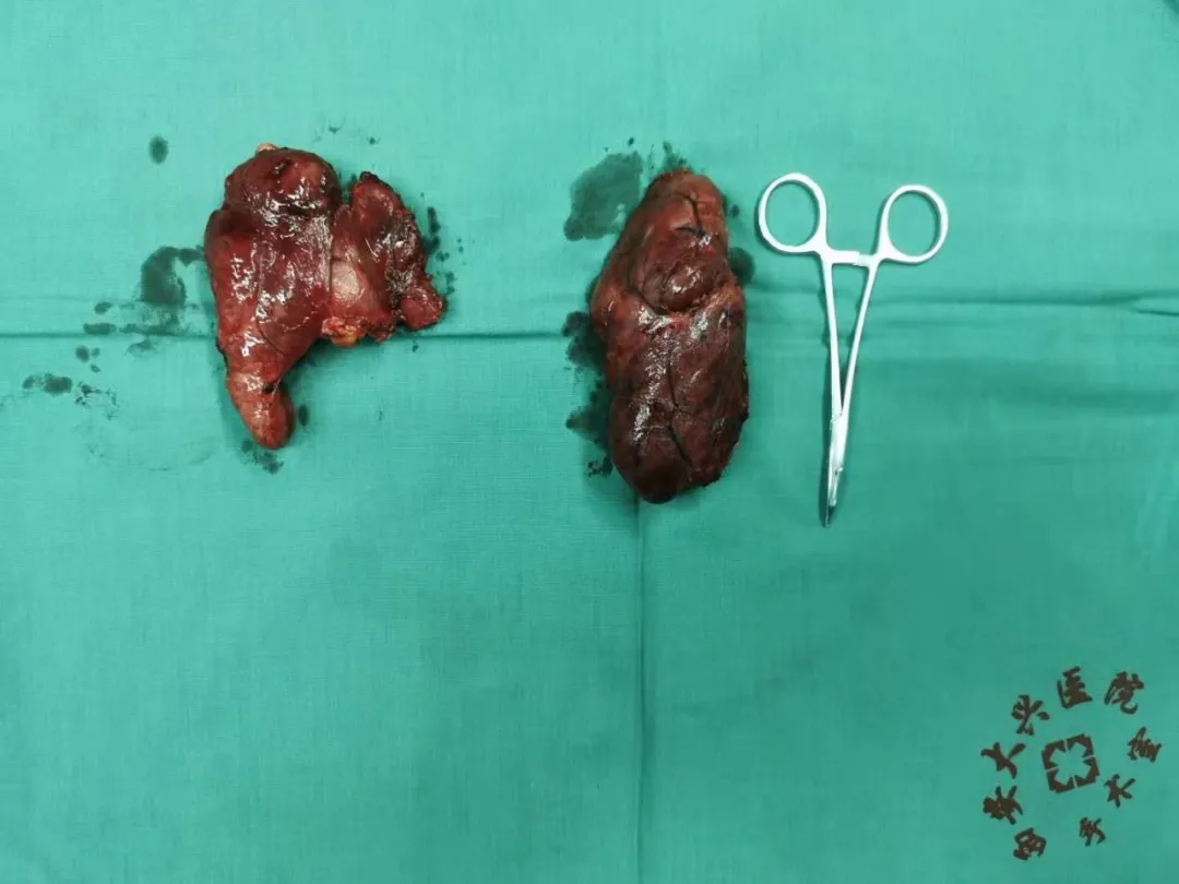 喘不过气！张姐被脖子上的俩大「腰子」扼住了喉咙