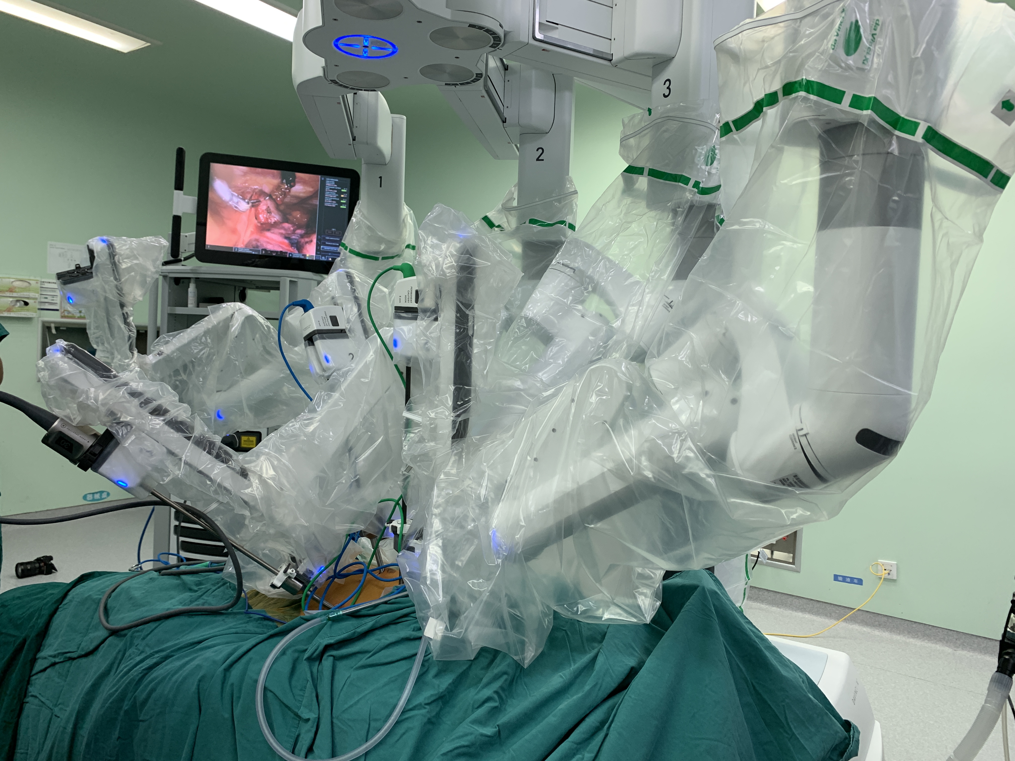 「神队友」奥利给！ 苏大附一院胸外科与机器人携手完成肿瘤切除术！