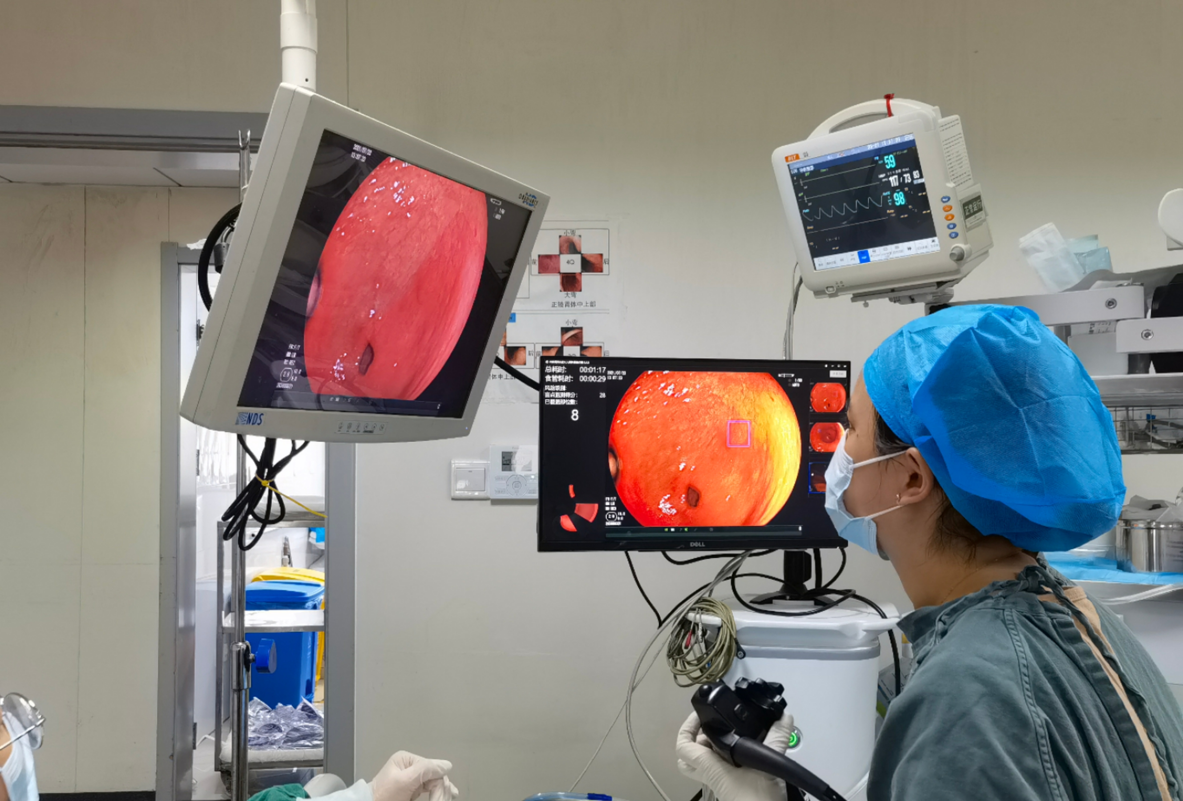 武汉大学人民医院在《柳叶刀》子刊发表研究成果：人工智能（AI）辅助内镜检查可降低近八成胃肿瘤漏检风险