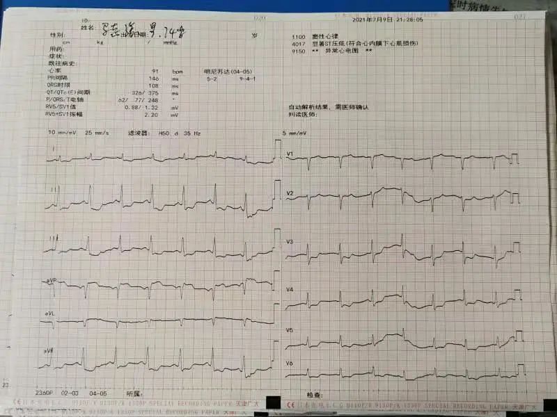 延安大学附属医院成功实施主动脉球囊反搏下冠状动脉旁路移植术