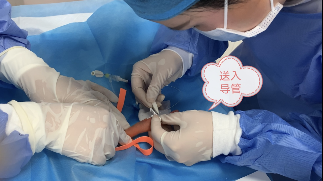登封市人民医院成功开展新生儿经外周静脉置入中心静脉导管术（PICC）