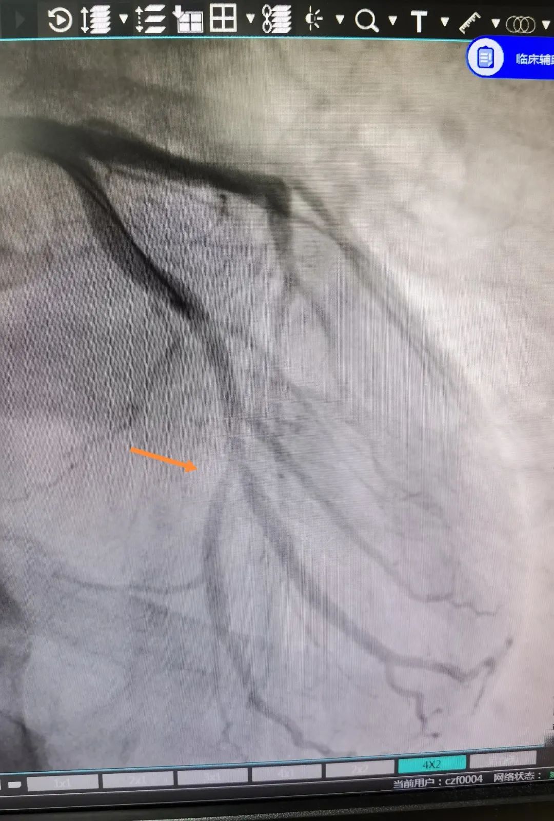 湖州市中心医院:砥砺奋进,书写学科发展「心」篇章