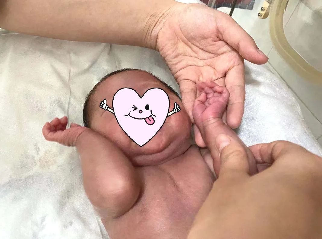 爱心守护，30 周早产的「巴掌婴儿」健康出院啦