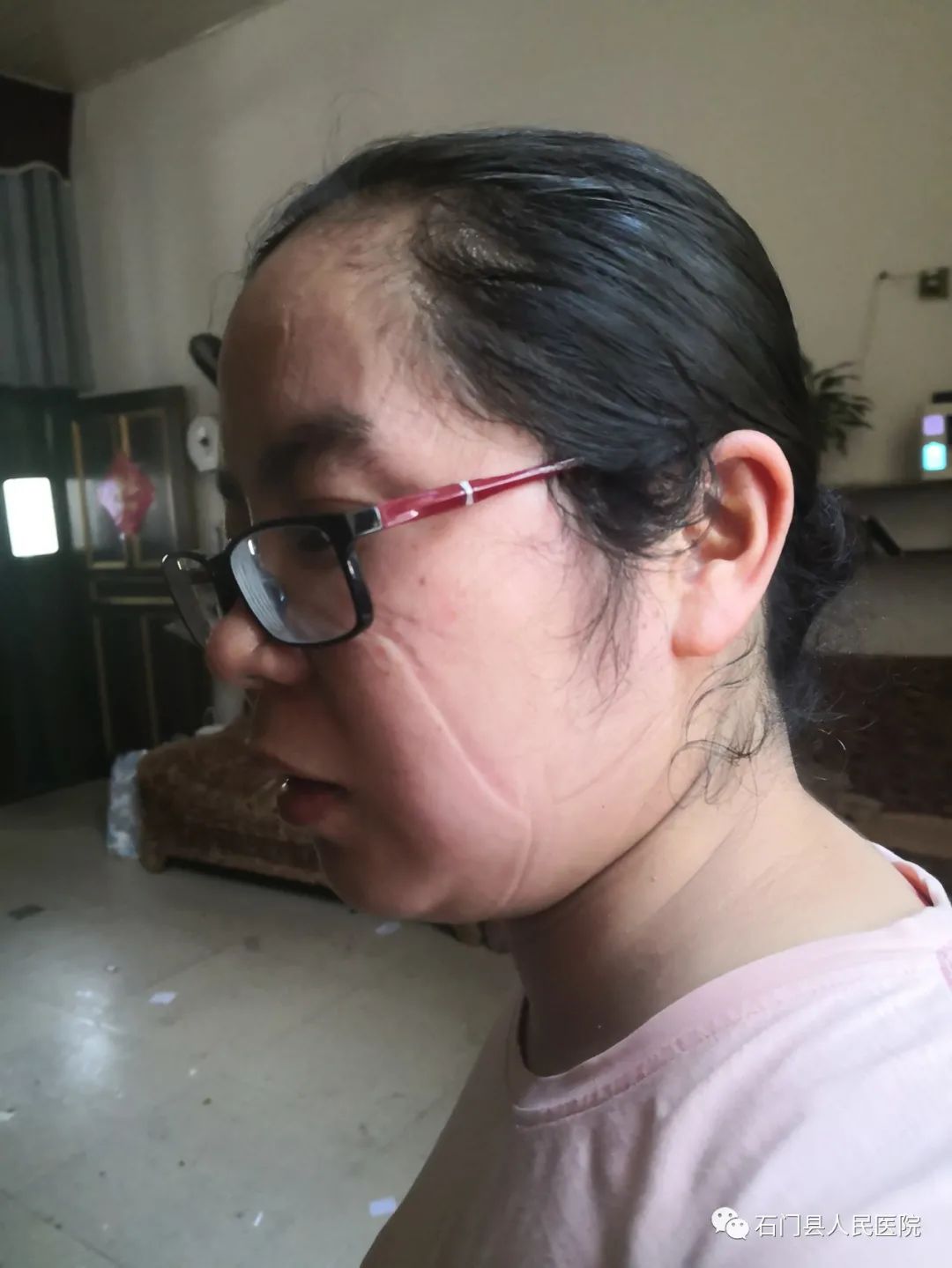 看完这些照片泪目！今天，石门县人民医院 16 名护理人员驰援常德！