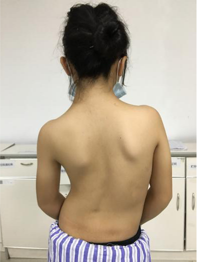 桂林医学院附属医院成功为 S 型少女完成华丽蜕变