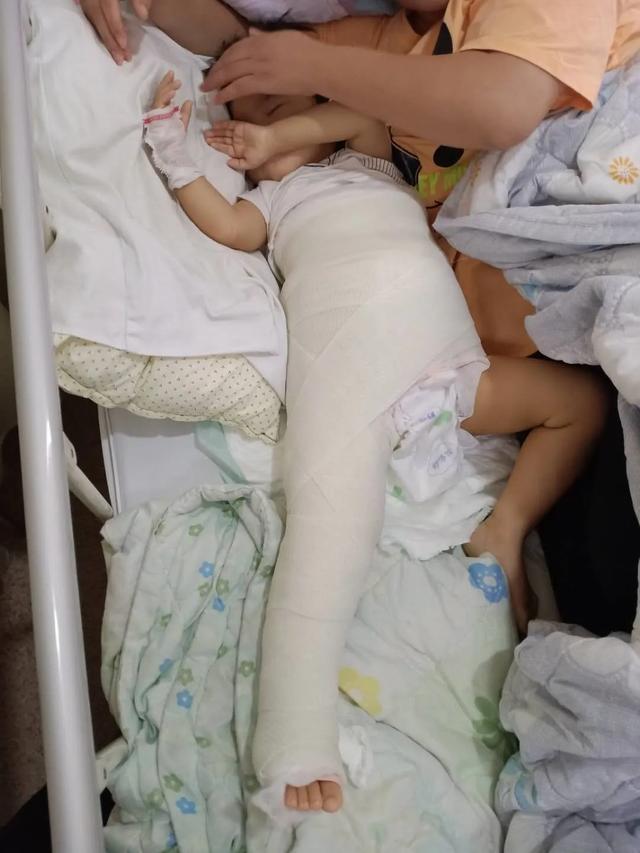 阜阳市妇女儿童医院实施发育性髋关节脱位骨盆截骨复位手术