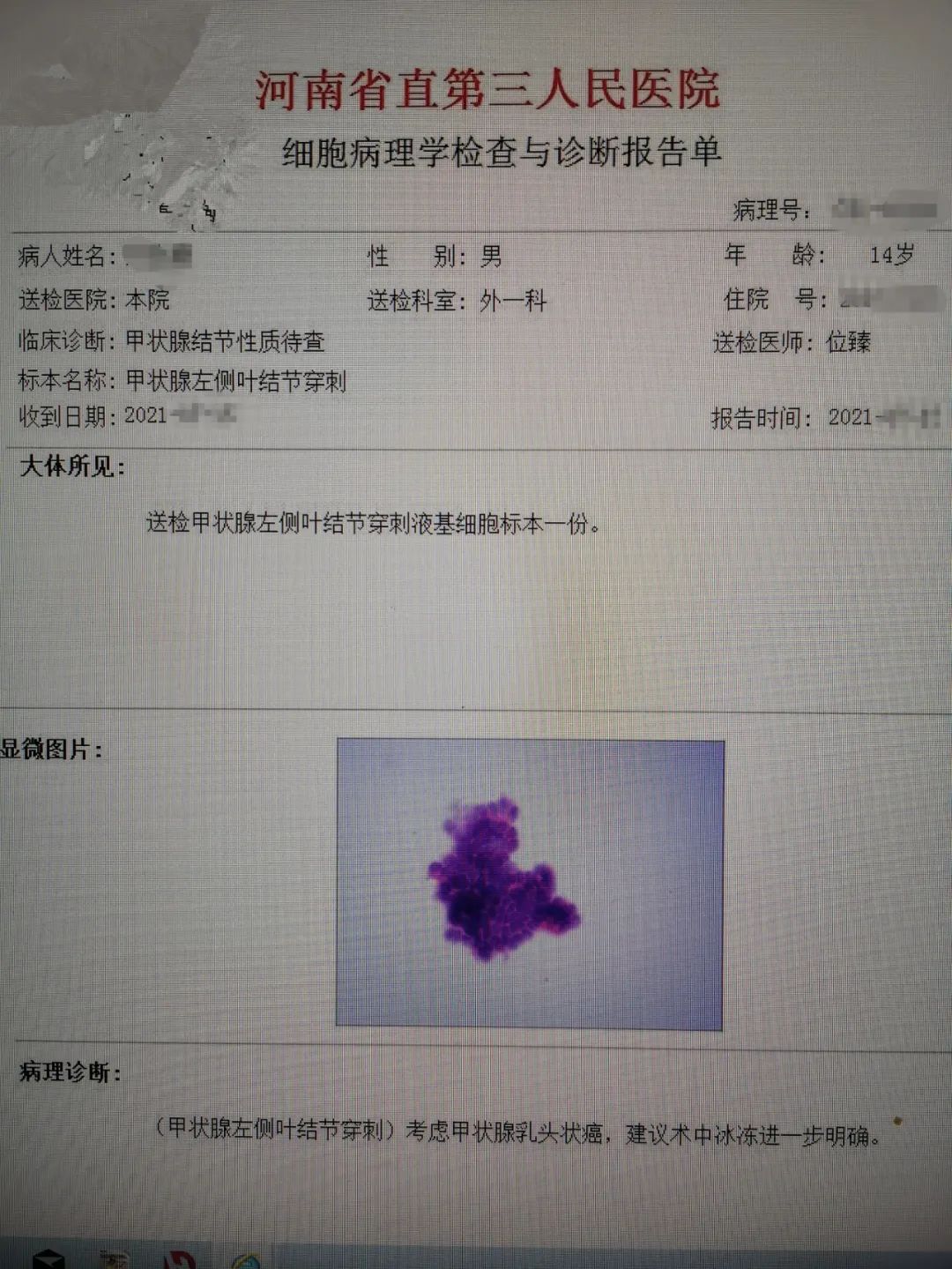 14 岁少年确诊甲状腺癌，青少年发病率上升