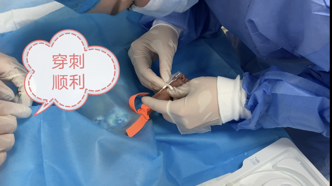 登封市人民医院成功开展新生儿经外周静脉置入中心静脉导管术（PICC）