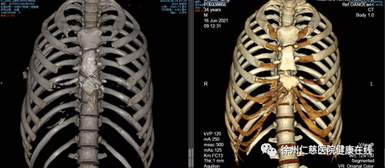 一失足要人命!高处坠落因何频发?