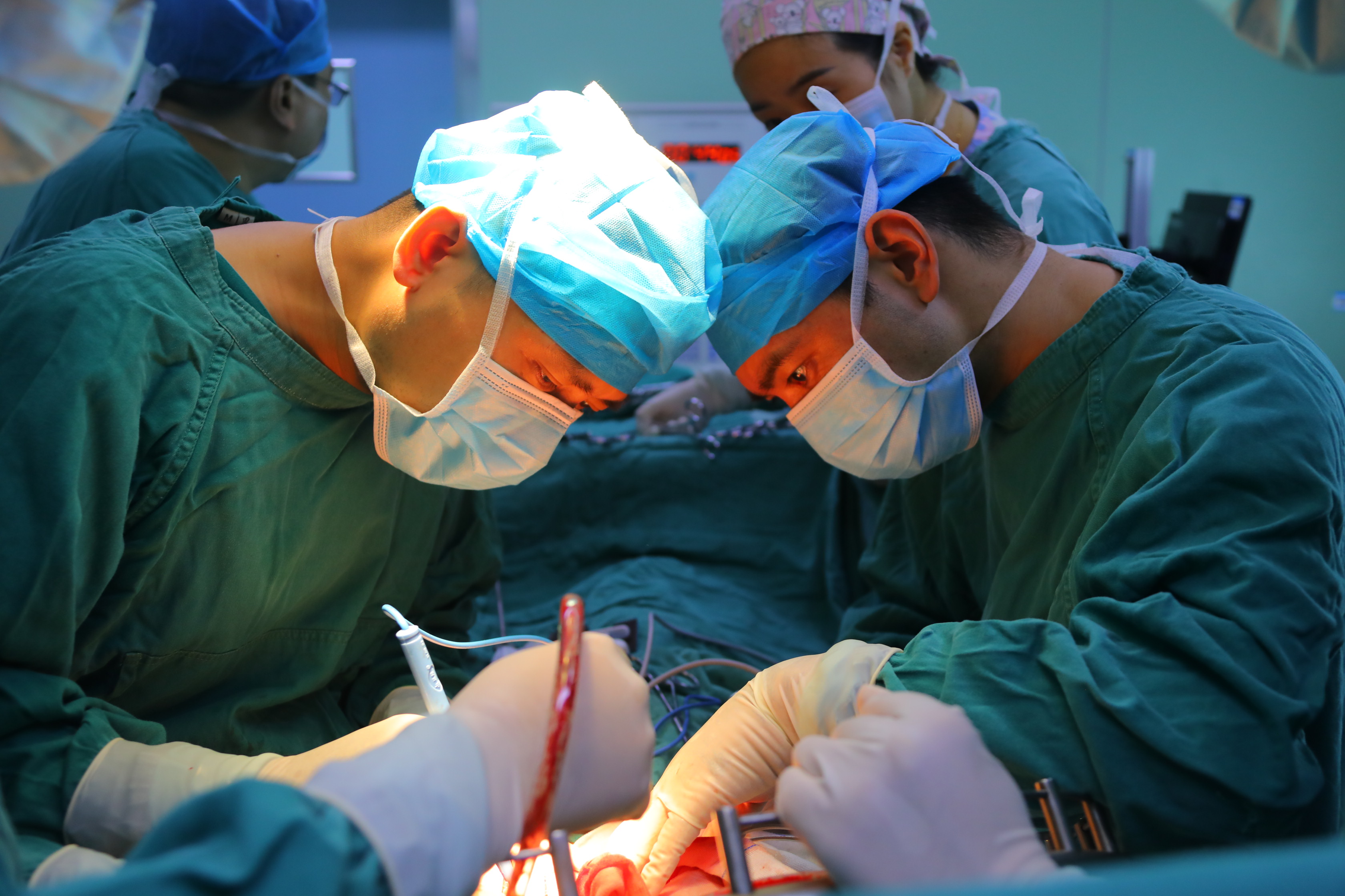 华西广安医院成功开展首例全胰联合脾脏切除手术