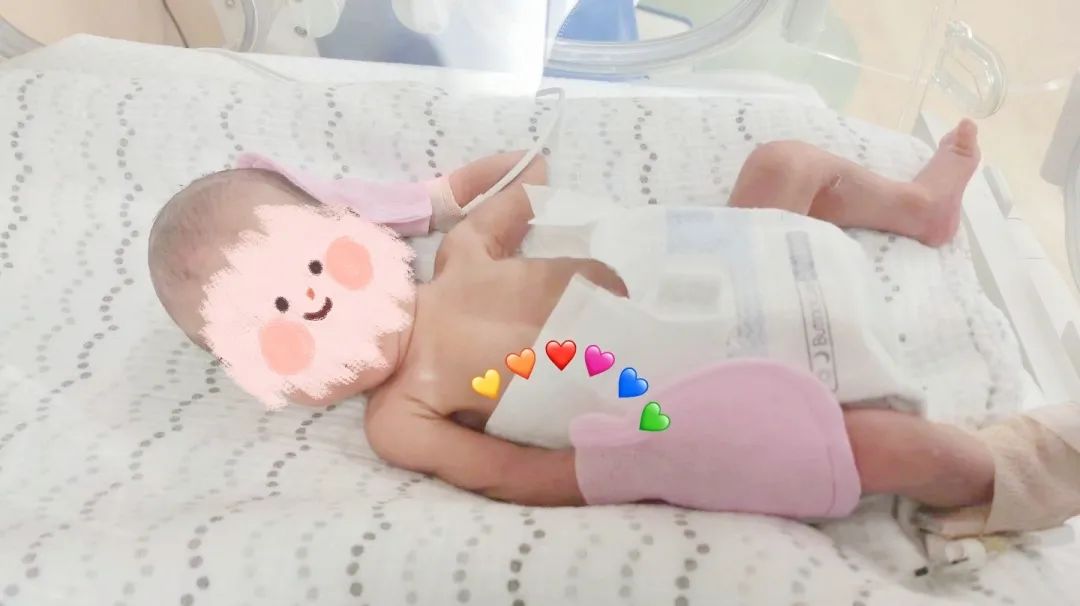 刷新纪录！杭州贝瑞斯美华成功救治 2kg 低重早产儿