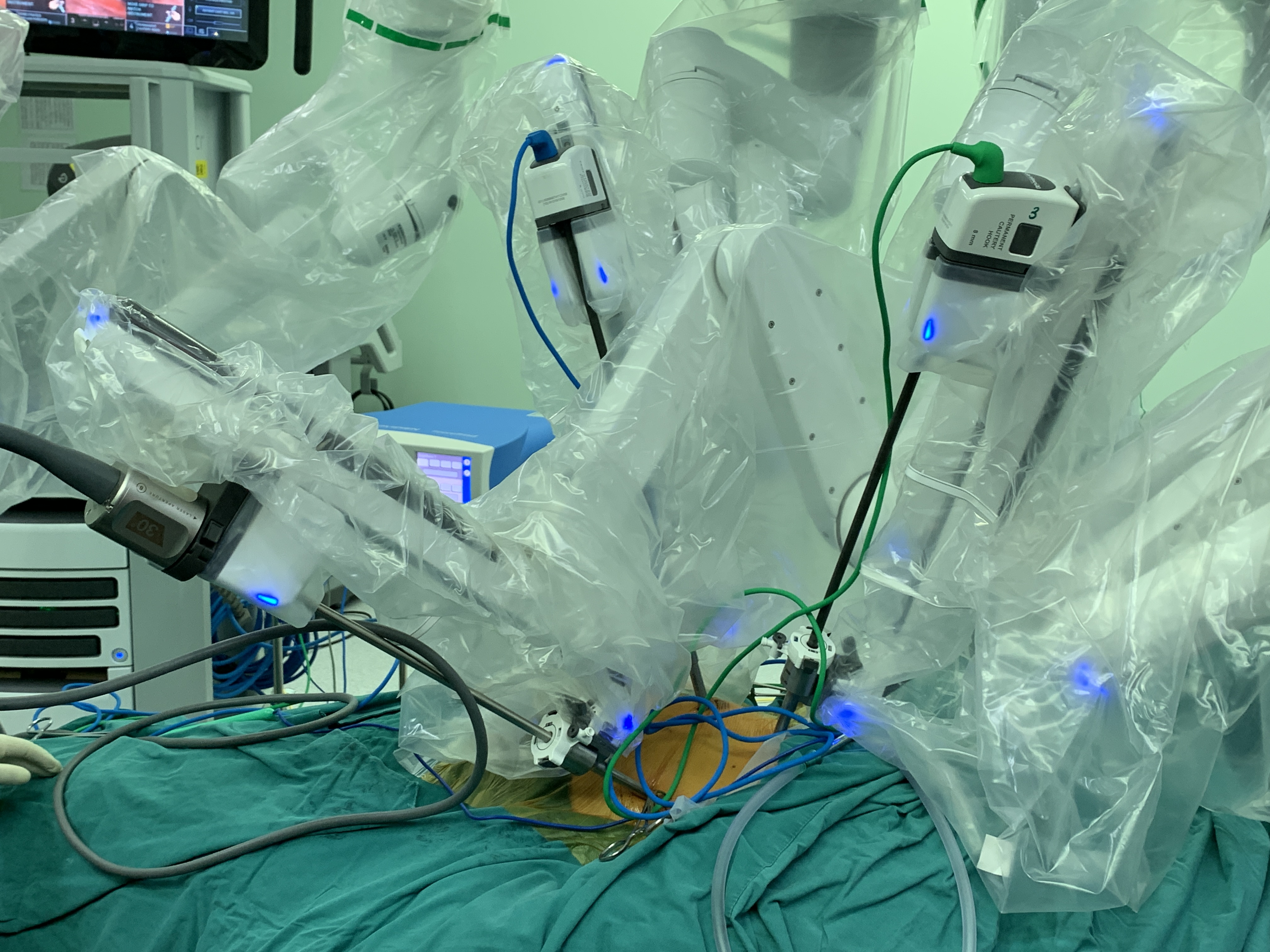 「神队友」奥利给！ 苏大附一院胸外科与机器人携手完成肿瘤切除术！
