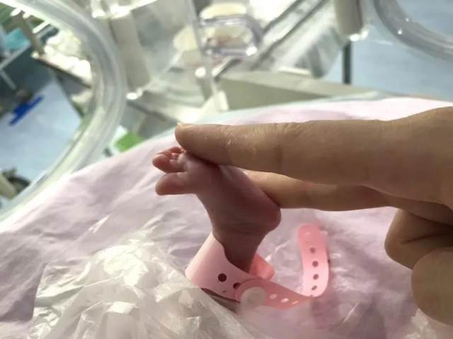 爱心接力！ 宫内转运成功救治高龄产妇，32 周早产双胞胎转危为安