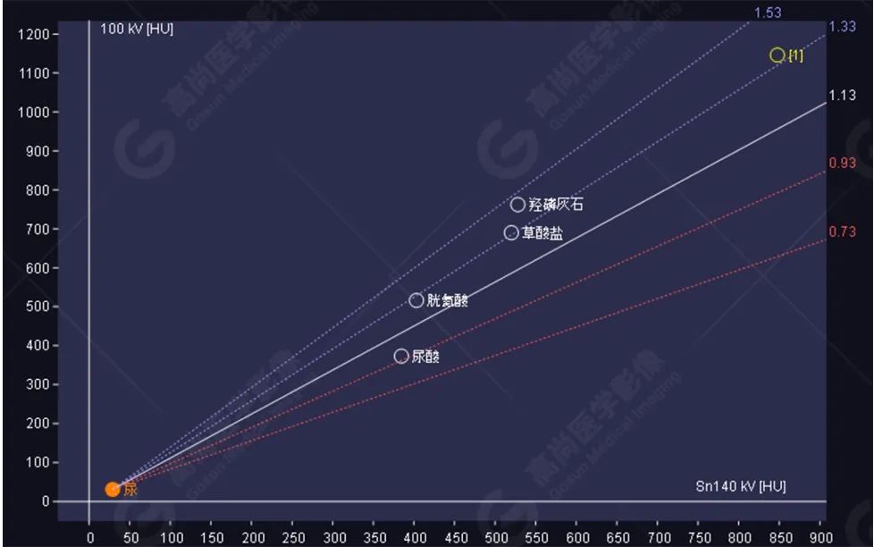 高尚病例:双能量 CT 成像分析泌尿系结石成分