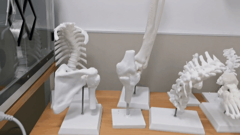 骨科 3D 打印 | 科技引领医学新未来