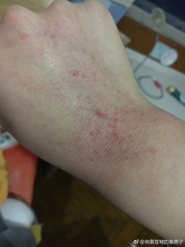 有一种名片，叫护士的手