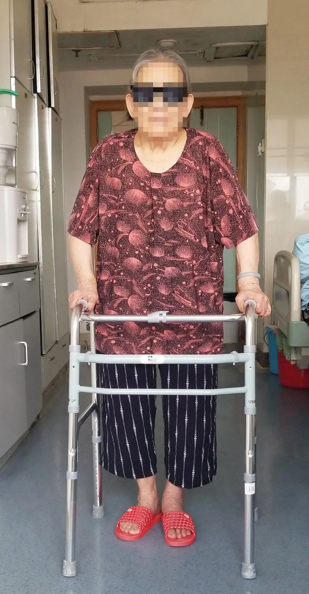 桂林医学院附属医院 3D 打印技术助力 92 岁患者进行高难度手术并快速康复