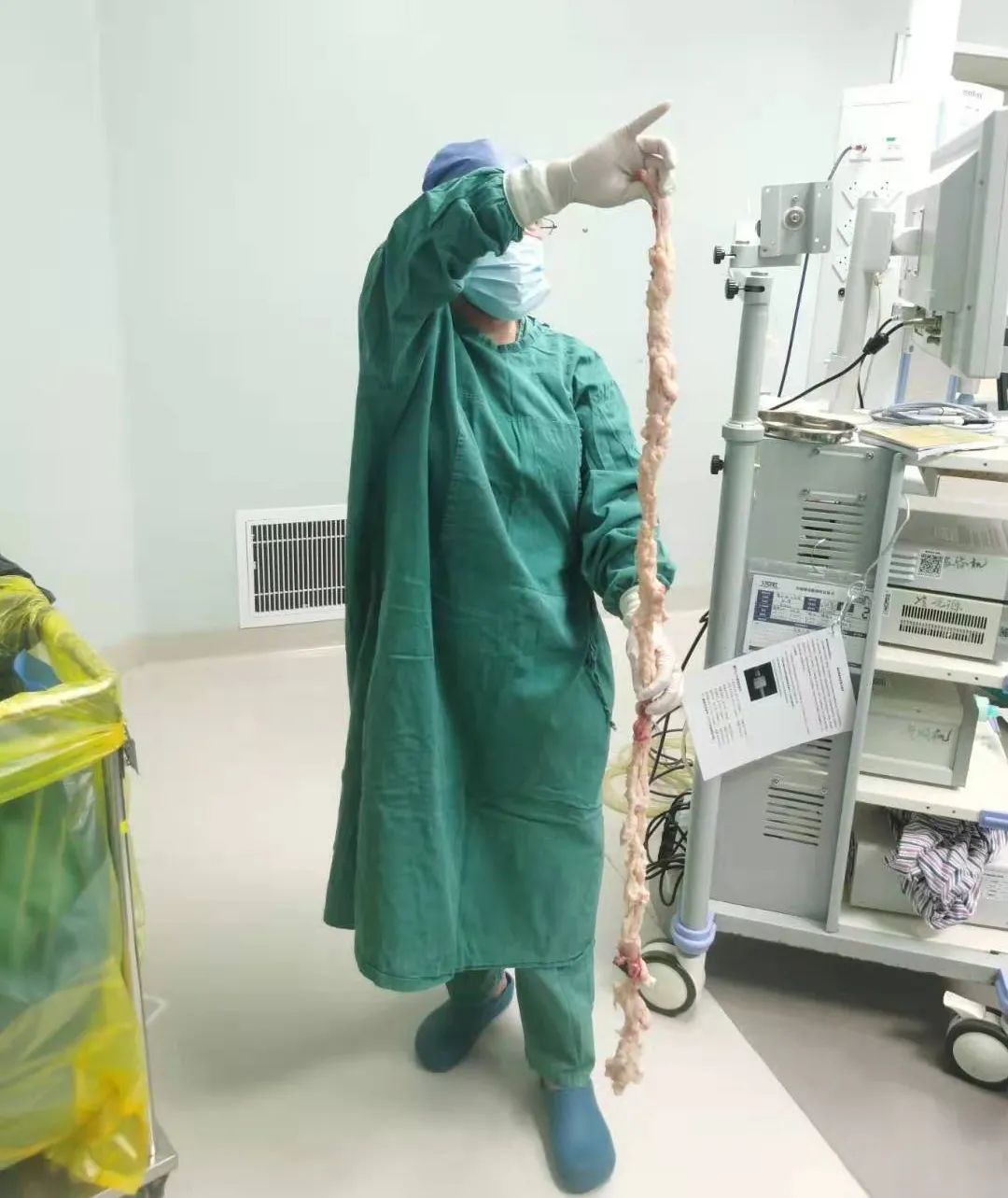 震惊！医生从她的肚子里掏出长达 1.6 米的子宫肌瘤