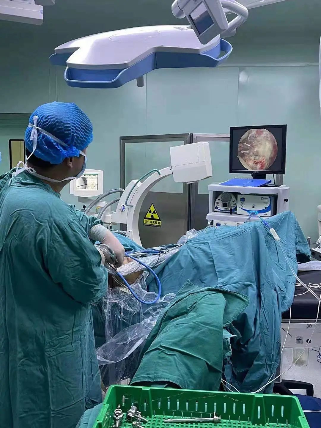 淮安市第一人民医院关节外科开展髋关节游离体微创手术