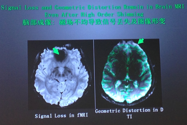 China-INI：重视神内、基础、影像、放射多学科协作