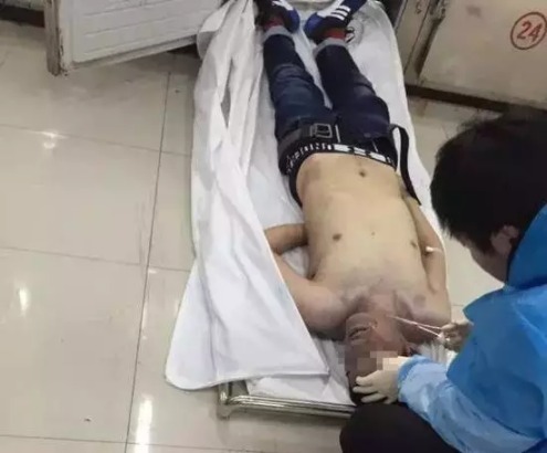 研究生参加导师饭局饮酒死亡！急诊医生告诉你酒精中毒如何应对