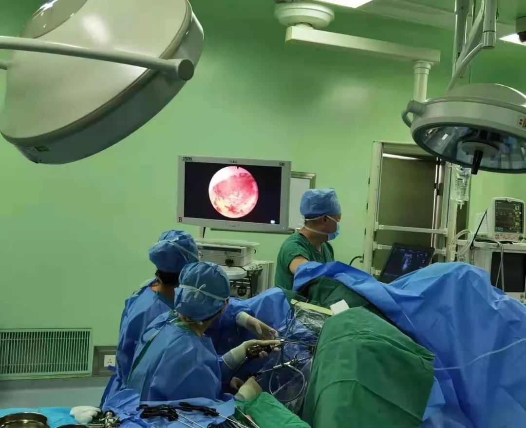 延安大学附属医院成功开展宫腔镜下冷刀系统微型剪分离重度宫腔粘连术