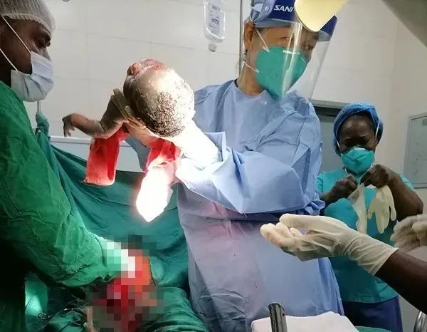 天津市蓟州区人民医院产科医生高雅波践行初心援助刚果（布）