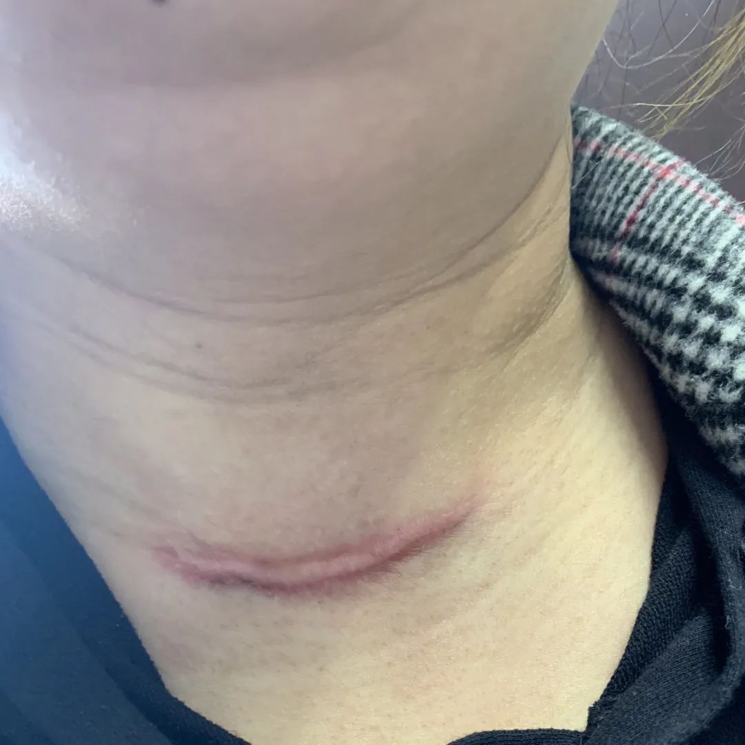 湖州市中心医院：击「甲」战士 身怀绝技 刀过无「痕」，原来秘技在此......