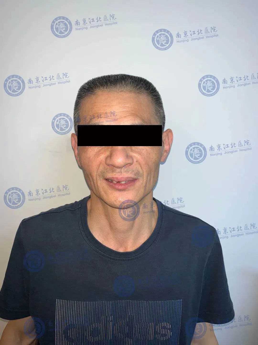 南京江北医院口腔科助力患者重拾笑容和年轻