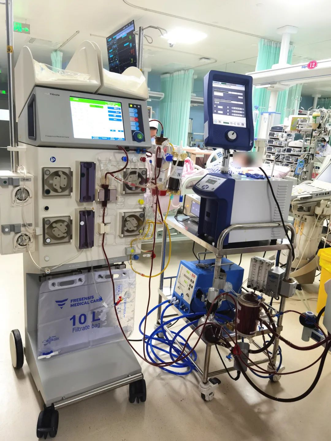 陕西省首例！西安高新医院为重症患者实施 ECMO 串联 DPMAS 治疗