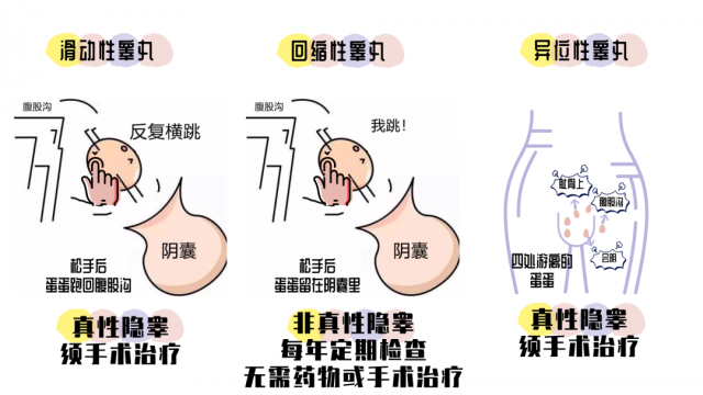 徐珊主任：解读并推广隐睾专家共识，提高疾病诊疗水平