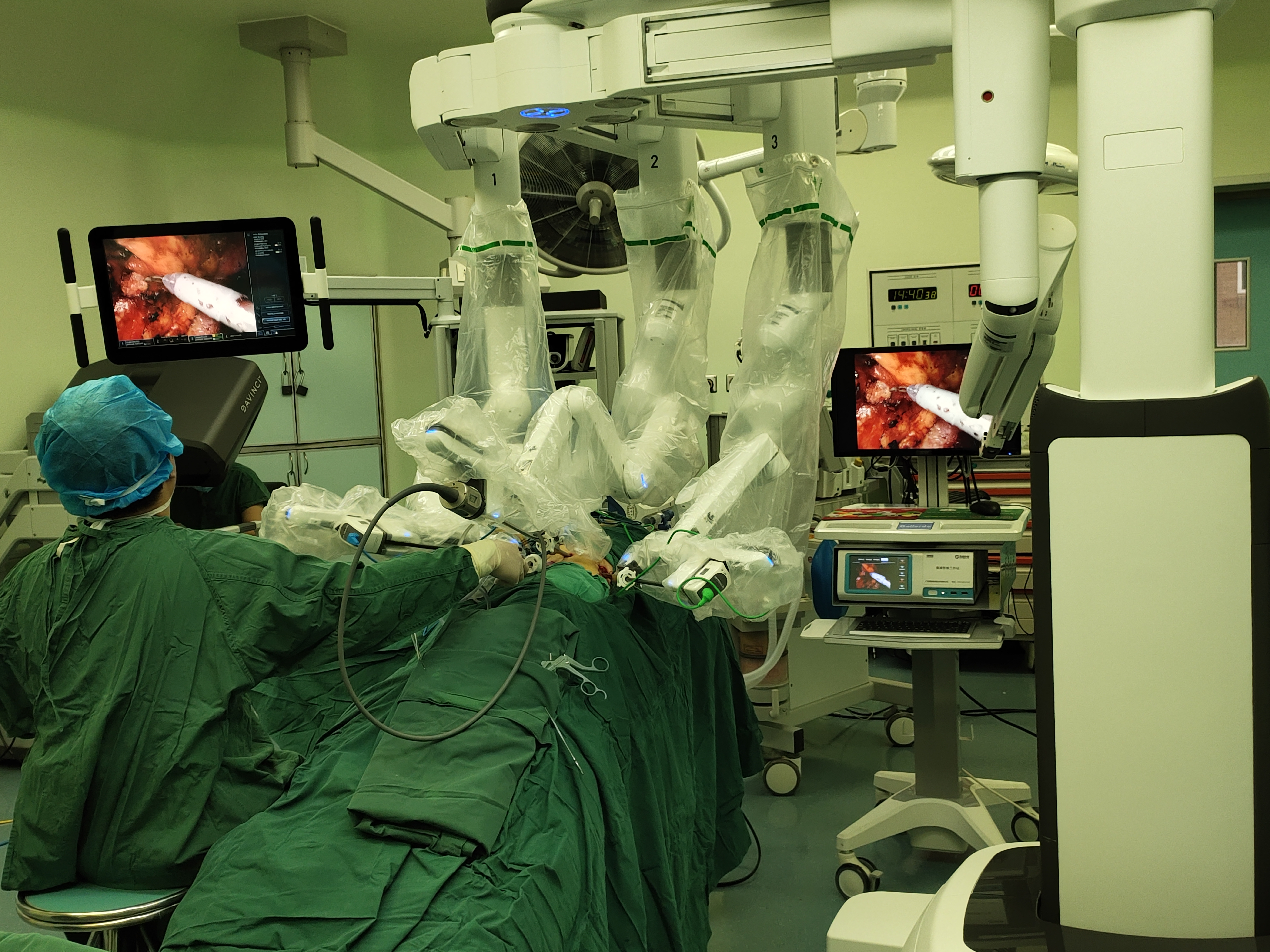 河大附院泌尿外科达芬奇机器人手术突破200例