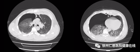 一失足要人命!高处坠落因何频发?