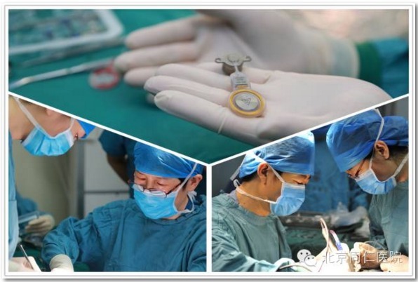 韩德民院士团队在北京同仁医院完成全国首例骨桥植入手术