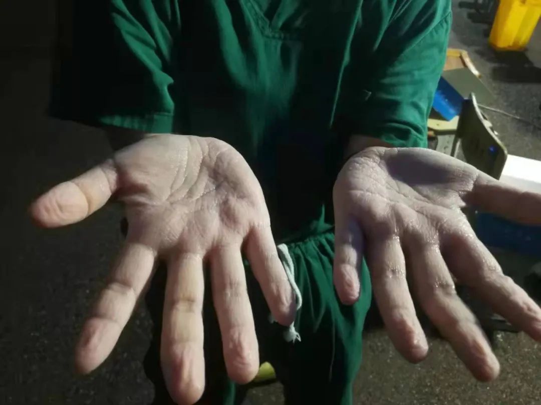 常德市第四人民医院：4 名逆行天使在张家界战斗的日子