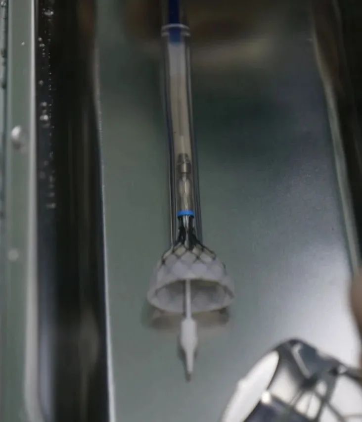 合肥京东方医院首例 TAVR 手术成功,心脏主动脉瓣置换现已进入「介入换新」时代