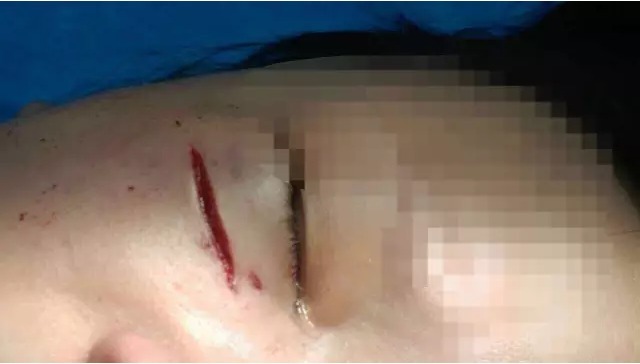 道歉、拘留,他们就是这样应付暴力伤医的